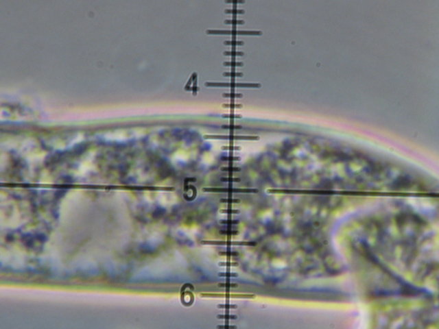 Botryobasidium con spore finemente verrucose
